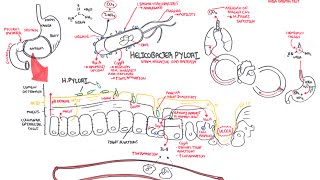 Microbiology  Helicobacter Pylori Ulcer [upl. by Kolodgie]