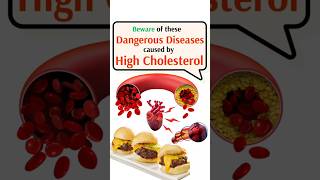 Dangerous diseases caused by HIGH CHOLESTEROL [upl. by Nylrats]