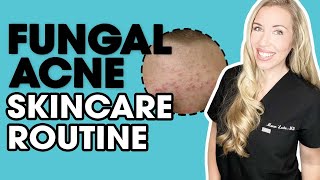 Fungal Acne Skincare Routine  Musthave Products  The Budget Dermatologist [upl. by Nireil]