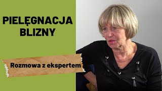 Odcinek 58 Pielęgnacja i mobilizacja blizny [upl. by Dario]