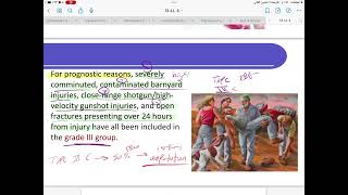 Orthopaedic injures of the lower limb دكتور احسان [upl. by Kelbee]