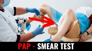 Pap  smear test [upl. by Noit]