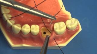 Surgical Technique  Figure of Eight Close Vertical Dental amp Medical Suturing by Stuart OrtonJones [upl. by Ynomrah]