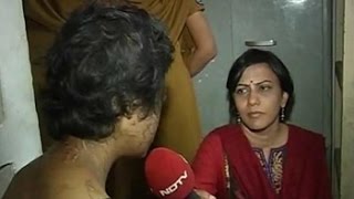 Battered bruised teenager rescued in Hyderabad alleges torture by stepmother [upl. by Cock]