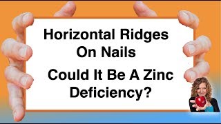 Horizontal Ridges On Nails Could it be a Zinc Deficiency With Karen Langston [upl. by Akenihs835]