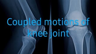 Knee joint MotionsOsteokinematics and Arthrokinematics [upl. by Esinert129]