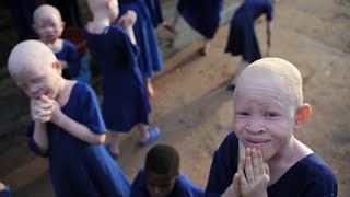 Albino People Hunted In Tanzania [upl. by Trab]