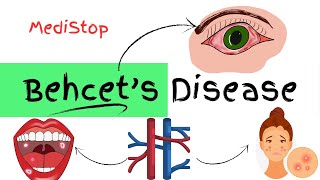 Behcets Disease explained  Signs amp Symptoms Diagnosis Treatment [upl. by Hanforrd]