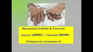 Rheumatoid Arthritis l Ayurveda l Amavata l vatarakta l stages of RA l Pathogenesis l samprapti [upl. by Nelyahs]