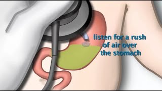 Nasogastric Tube Placement by S Hamilton  OPENPediatrics [upl. by Anaujd]