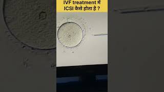 ICSI Procedure in IVF Intracytoplasmic sperm injection fertilitytreatment ivfjourney ivfsuccess [upl. by Artemisia]