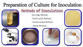 Preparation Of Inoculation  Method Of Inoculation [upl. by Sevy921]