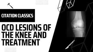 Sports Citation Classics 05 OCD Lesions of the Knees and Treatment [upl. by Paradies]