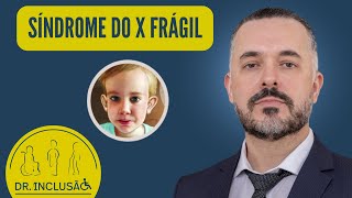 SÍNDROME DO X FRÁGIL O QUE É CAUSAS SINTOMAS DIAGNÓSTICO TRATAMENTO DICAS INCLUSIVAS [upl. by Noscire]