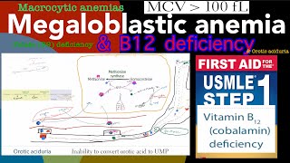 Megaloblastic anemia Vitamin B12 Cobalamin deficiency in HindiUrdu by first aid for USMLE step 1 [upl. by Lyrrad383]