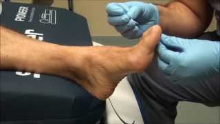 60 Second Diabetic Foot Screening Test  Explained [upl. by Jamill447]