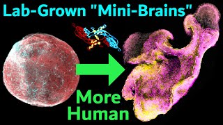 New Technique Makes Brain Organoids More Like Real Human Brains Expanded Neuroepithelium Organoids [upl. by Roter519]