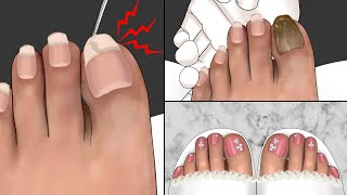 ASMR Foot Care Animation for a Photo Shoot🦶 Athletes foot Treatment Pedicure Makeup [upl. by Sibeal103]