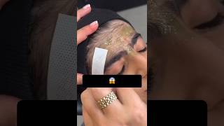 🔥 Remove Facial Hair At Home EasilyPermanent Foreheads amp Facial Hair Removalshortsviralvideo diy [upl. by Yedrahs]