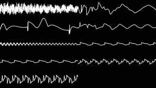 Stéphane Picq  Maeva  MegaRace  Oscilloscope View [upl. by Errecart321]