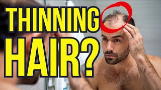 Top Solutions for Thinning Hair [upl. by Lupe613]