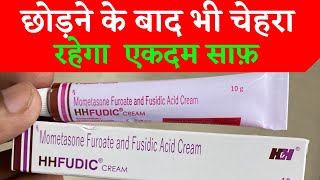 HH Fudic cream  Uses benefits Side effects  For Clean face remove pimple amp acne  Hindi [upl. by Thais]