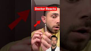 ER Doctor REACTS to Draining Cauliflower Ear [upl. by Akelahs]