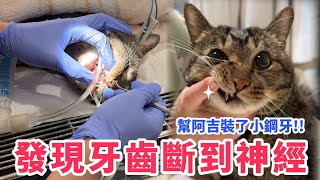 洗牙發現牙齒斷到神經！？幫阿吉裝了小鋼牙！【麻吉太郎】 [upl. by Htiffirg]