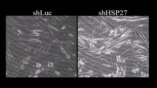 Knocking down of heatshock protein 27 directs differentiation of functional glutamatergic neurons [upl. by Enyr]