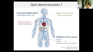 Comment prescrire une séance dhémodialyse intermittente [upl. by Dewees]