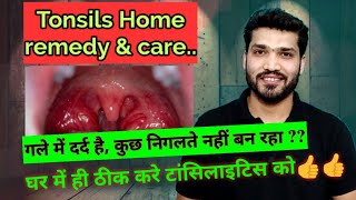 टॉन्सिलाइटिस घरेलू उपचार  Tonsillitis Home Remedies and care [upl. by Gillan]