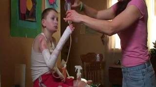 EJ had Epidermolysis Bullosa EB  quotThe Worst Disease Youve Never Heard Ofquot [upl. by Zoara]