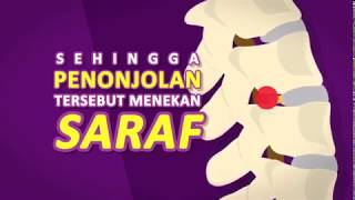 Saraf kejepit apa dan bagaimana penanganannya [upl. by Assirhc367]