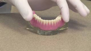 Implant Overdenture or an Implant Retained Denture [upl. by Pharaoh740]