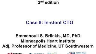 Case 8 Manual of CTO Interventions  Investment for ISR CTO [upl. by Oremor]