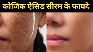 Kojic Acid Serum Benefits In Hindi [upl. by Anaerdna896]