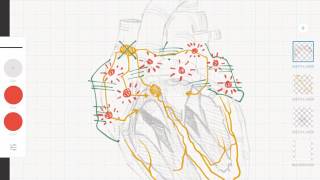 Cardiología y ECG Taquicardias supraventriculares vs ventriculares [upl. by Ennaira]