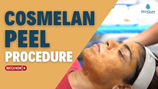 Cosmelan Peel Treatment  All about Cosmelan Peel  Antiageing Treatment Delhi  SkinQure [upl. by Andeee916]