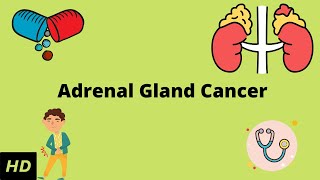 Adrenal Gland Cancer Causes Symptoms Diagnosis and Treatment [upl. by Cicily]