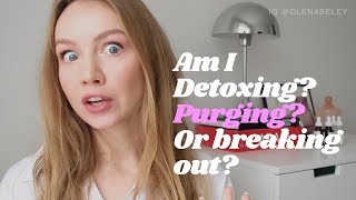 Am I Detoxing Purging Or Breaking Out The real reasons behind your breakouts [upl. by Rovit]