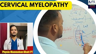 cervical myelopathy [upl. by Naujled]