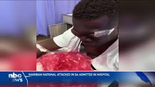 Namibian national attacked in SA admitted in hospital  nbc [upl. by Nerta318]