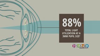 Trifocal lens could bring new options for cataract patients [upl. by Notnilk700]