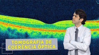 Tomografia de coerência óptica  Dr João Paulo Lomelino [upl. by Mord818]