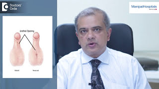 What is Hypospadias  hypospadias signs and symptoms  Dr CN Radhakrishnan  Manipal Hospitals [upl. by Sheffy]