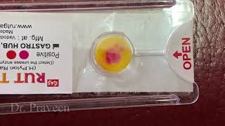 RAPID UREASE TEST FOR H PYLORI  TEST FOR GASTRITIS ULCER hpylori rutkit [upl. by Cantu]