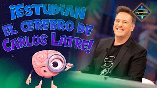 El cerebro de Carlos Latre a estudio  El Hormiguero [upl. by Ziana]