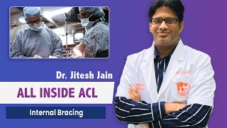 Internal bracing and allinside ACL Reconstruction in Jaipur by Dr Jitesh Jain Latest Technique [upl. by Ileane]