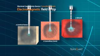 PediGuard Technology Electrical Conductivity Principle [upl. by Lecrad]