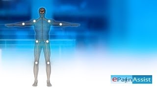 Fibromyalgia Explained Learn About 11 Tender Points Symptoms Causes of Fibromyalgia [upl. by Dyun655]